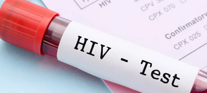 HIV HIV testing